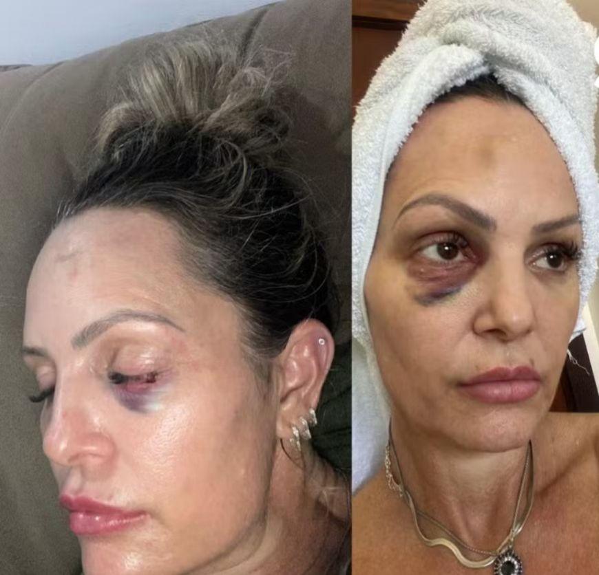 Policial é preso por agressão contra a ex-esposa personal trainer